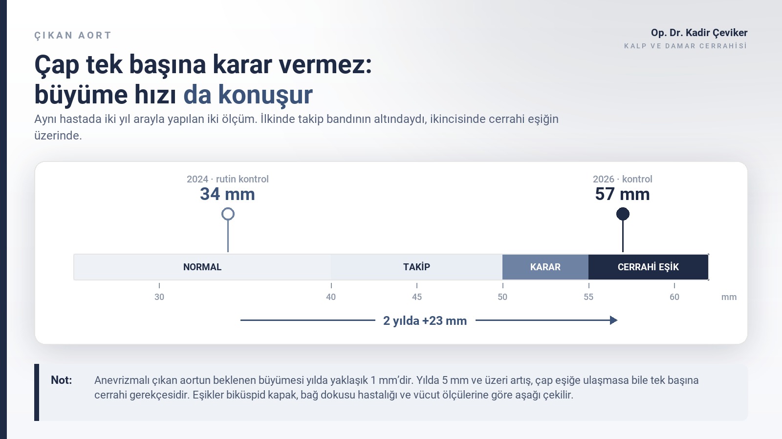 Çıkan aort çap skalası: 2024’te 34 mm olan ölçümün 2026’da 57 mm’ye, cerrahi eşiğin üzerine çıkışını gösteren şema